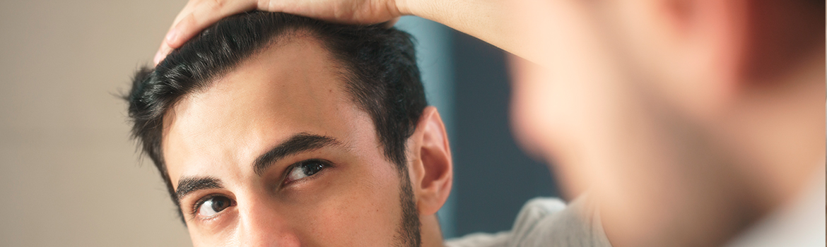 ¿Pierdes más pelo de lo habitual?
