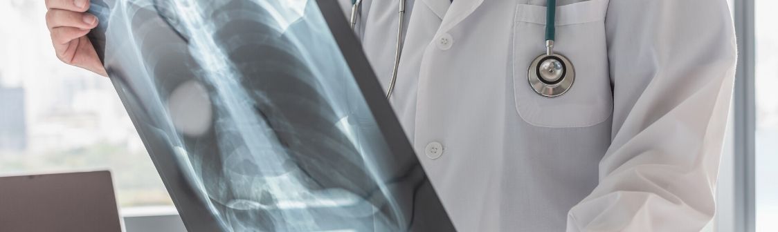 Cáncer de pulmón: El diagnóstico precoz si es posible
